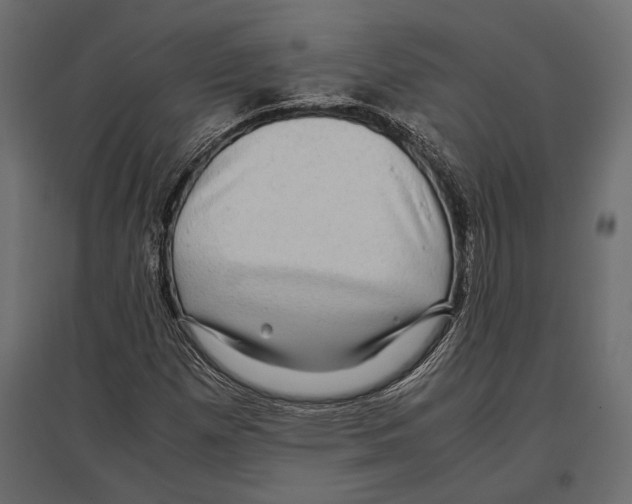 X0000096981257200803071021