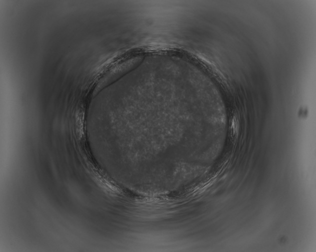 X0000096981348200803071020