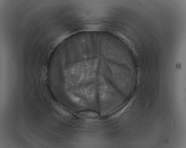 X0000096981449200803071019