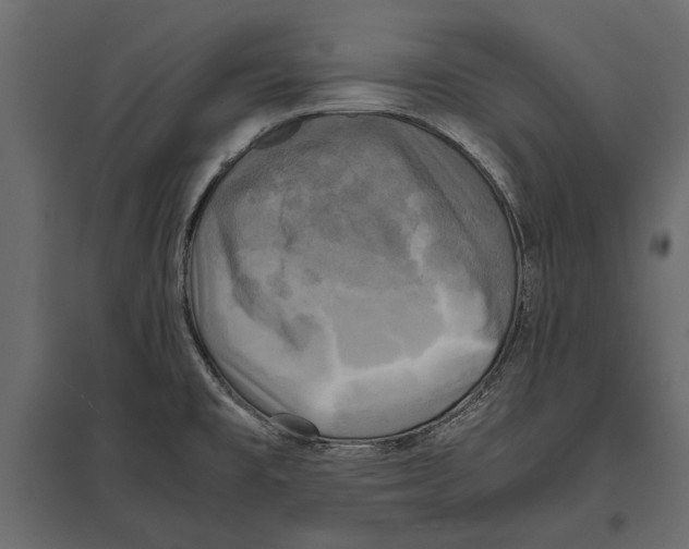 X0000096981477200803071018