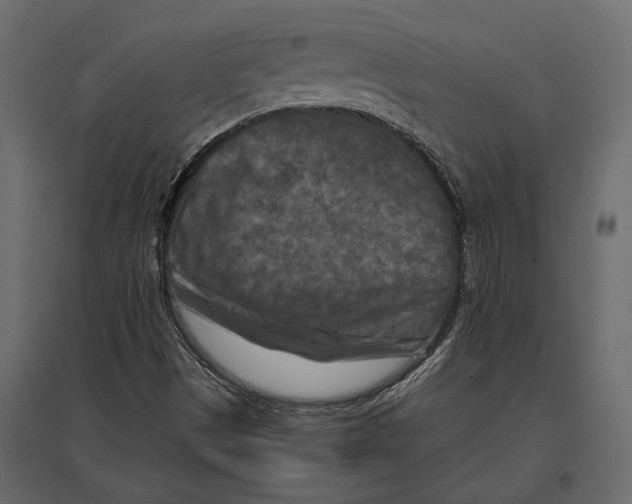 X0000096981497200803071017