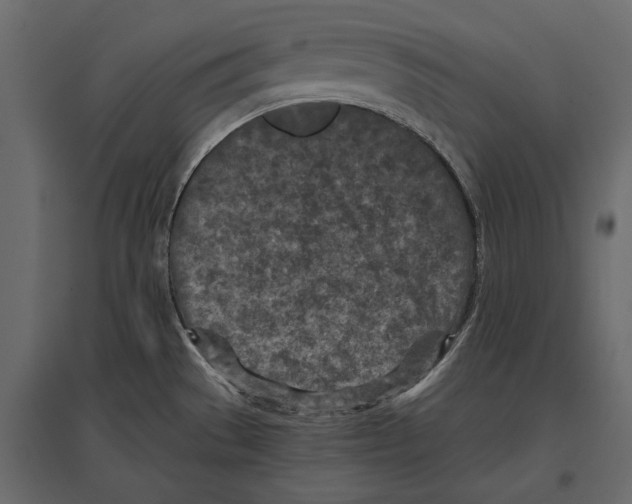 X0000096981529200803071018