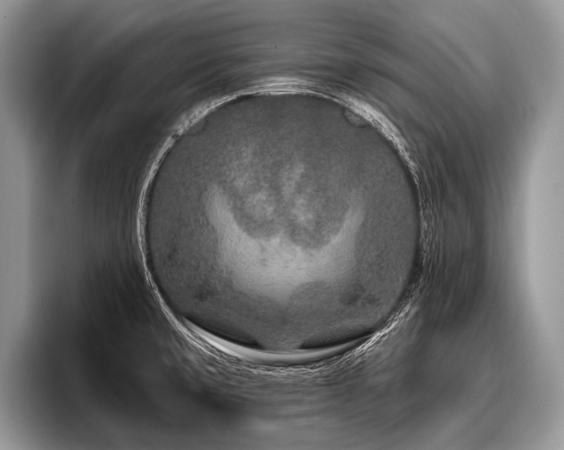 X0000096991429200802081418