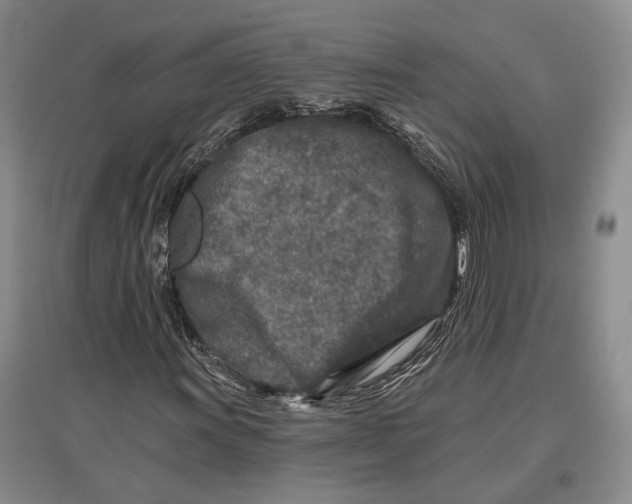 X0000096991011200802291204