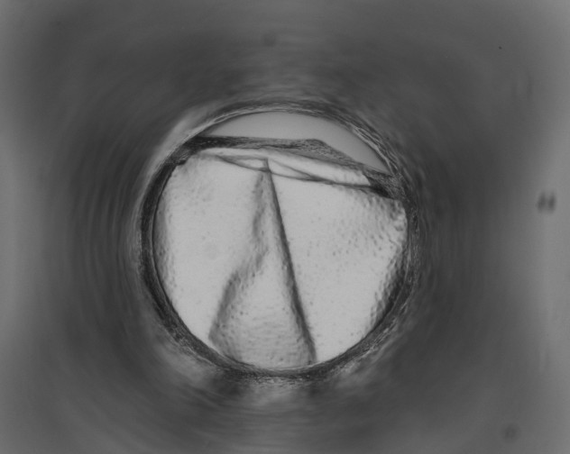 X0000096990198200803071101