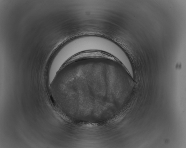 X0000096990304200803071059