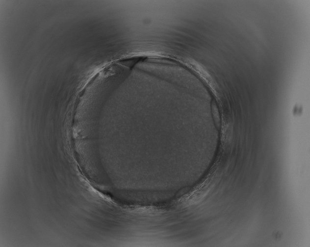 X0000096990385200803071058