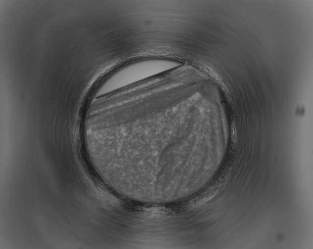 X0000096990396200803071058