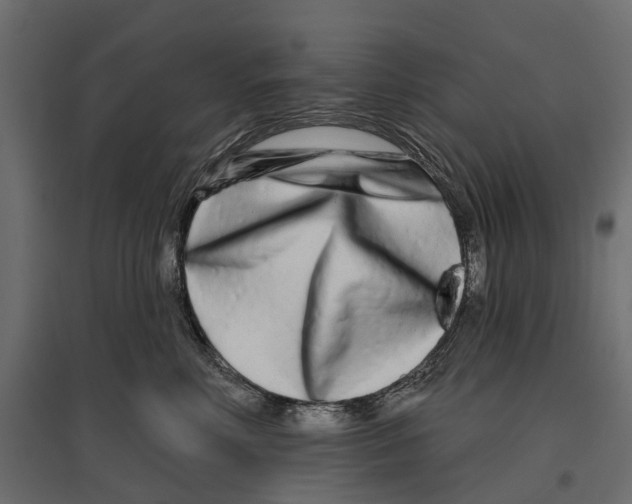 X0000096990618200803071055