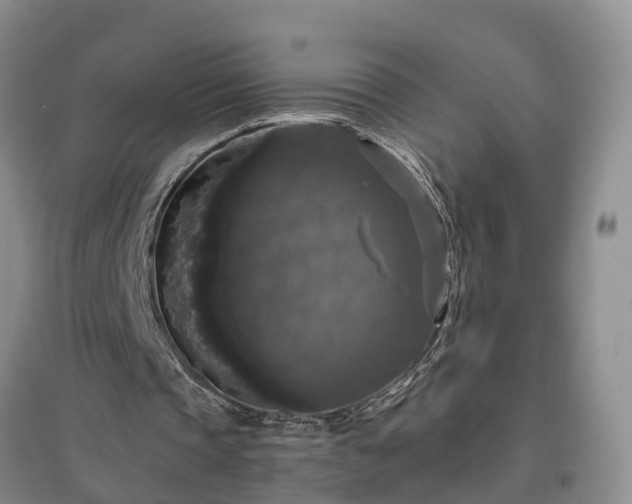 X0000097000337200802151419
