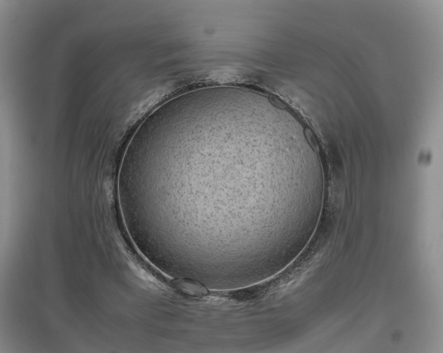 X0000097000393200802151419