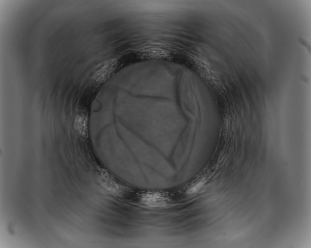 X0000097000177200802291156