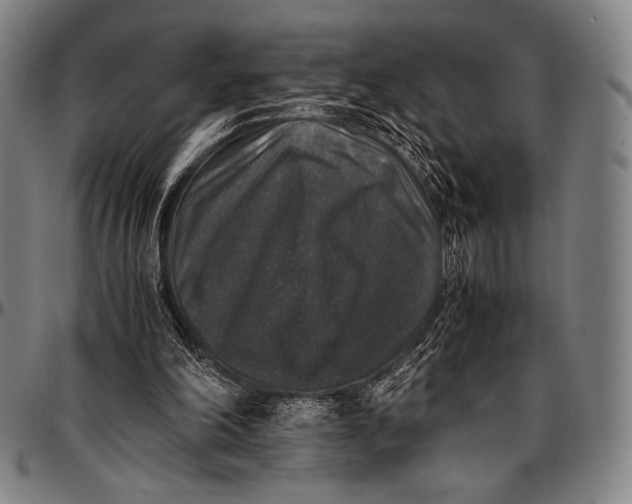 X0000097000198200802291155