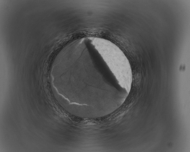 X0000097000913200803071113