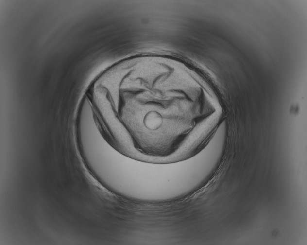 X0000097001471200803071105