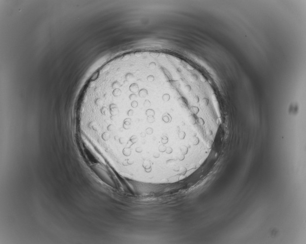 X0000097291467200803141500