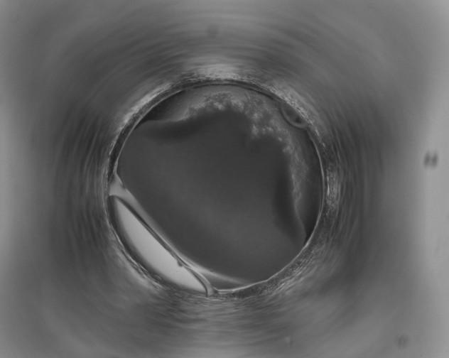 X0000097300390200802291818