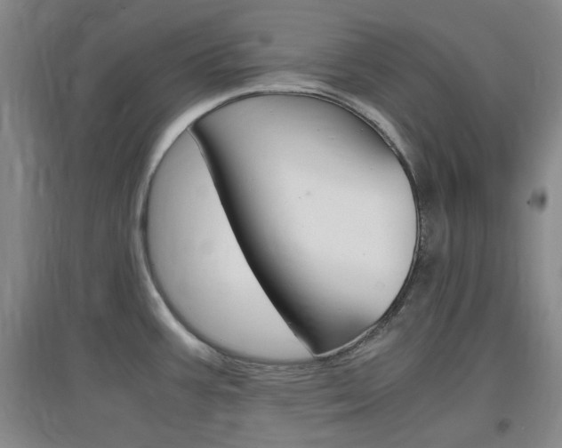 X0000097461387200802220757