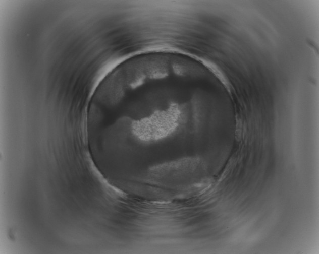 X0000097461295200803071623