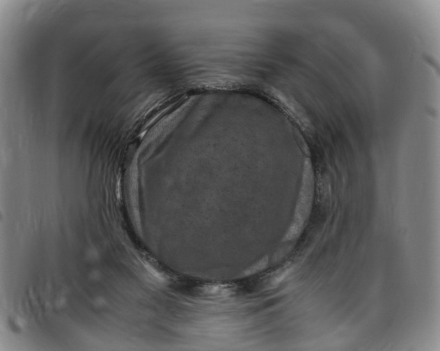 X0000097460117200803141900