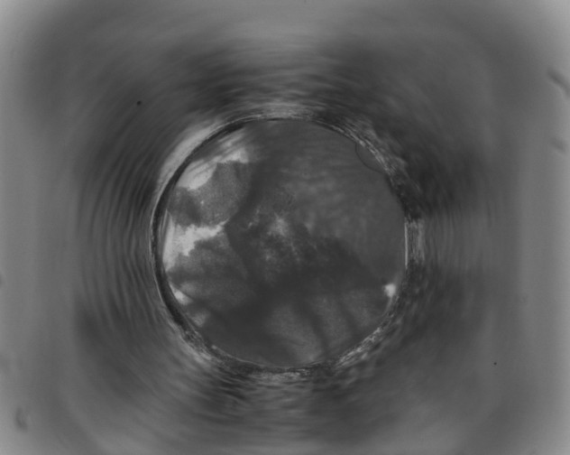 X0000097460147200803141859