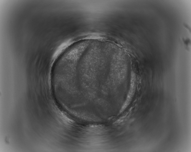 X0000097460296200803141857