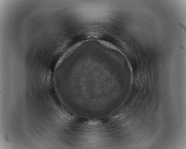 X0000097460314200803141857