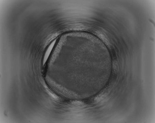 X0000097460397200803141856