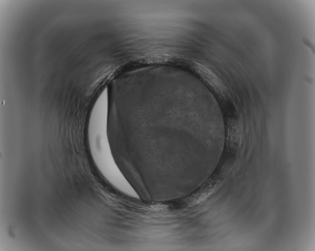 X0000097460501200803141855