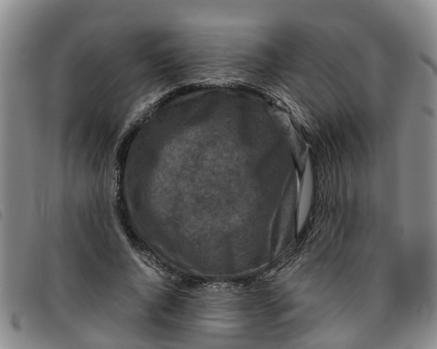 X0000097460736200803141851