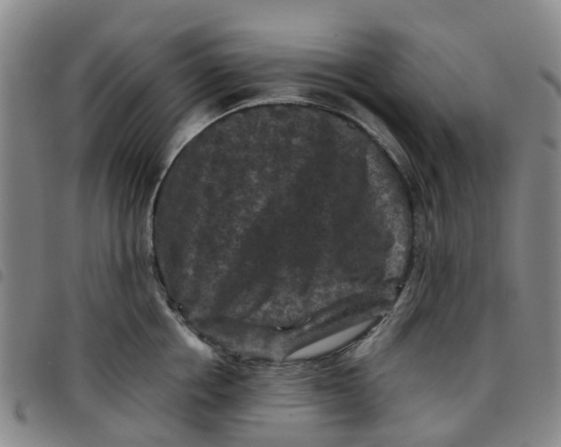 X0000097460858200803141850