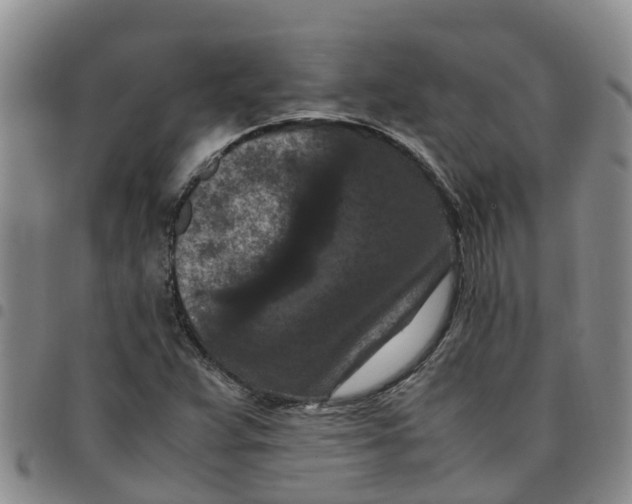 X0000097461359200803141842