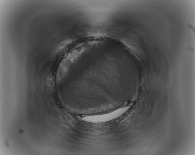 X0000097461398200803141841