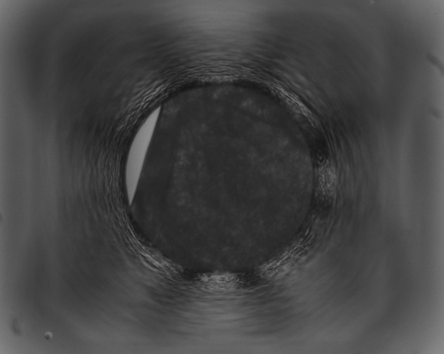 X0000097460517200803201429