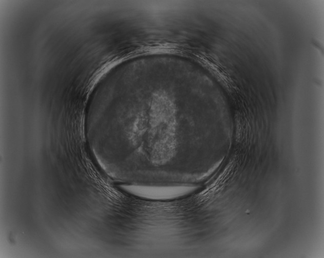 X0000097461174200803201420