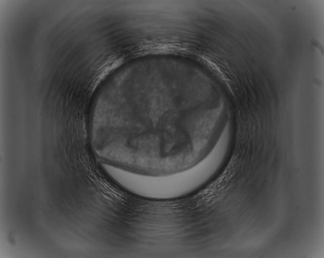 X0000097461218200803201419