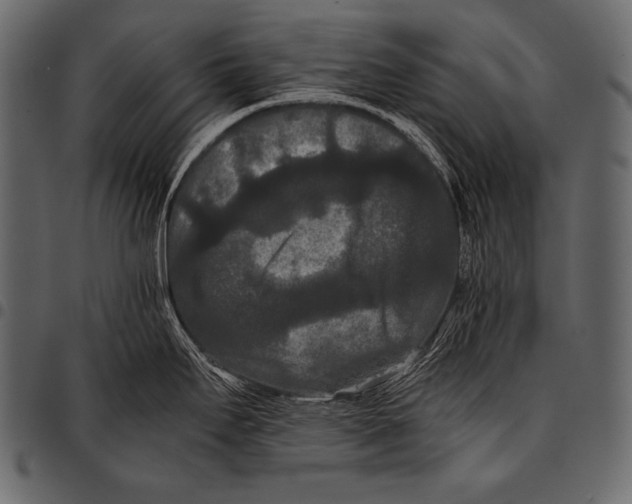 X0000097461295200803201418