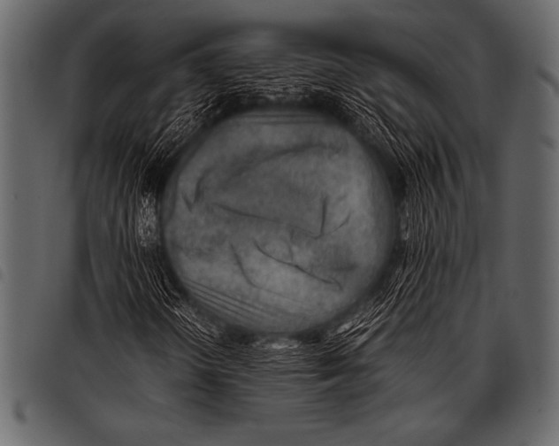 X0000097461298200803201417