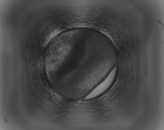 X0000097461359200803201417