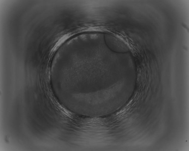 X0000097461367200803201417