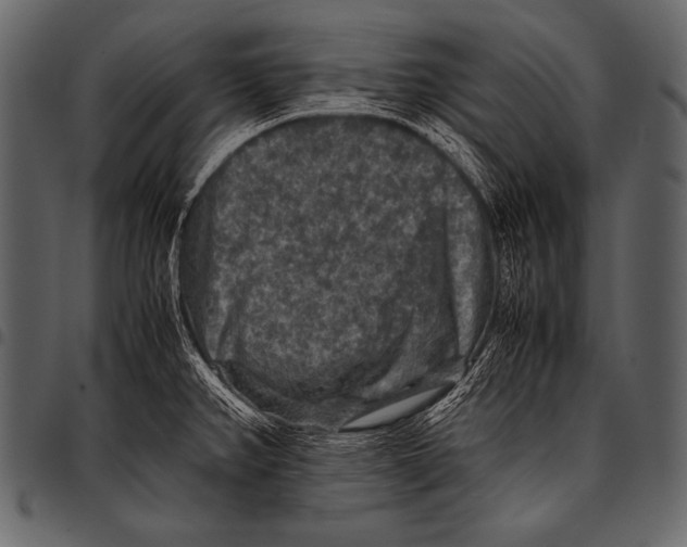 X0000097461382200803201417