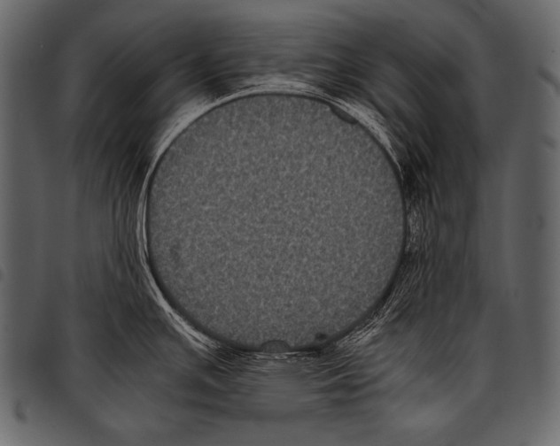 X0000097461391200803201417