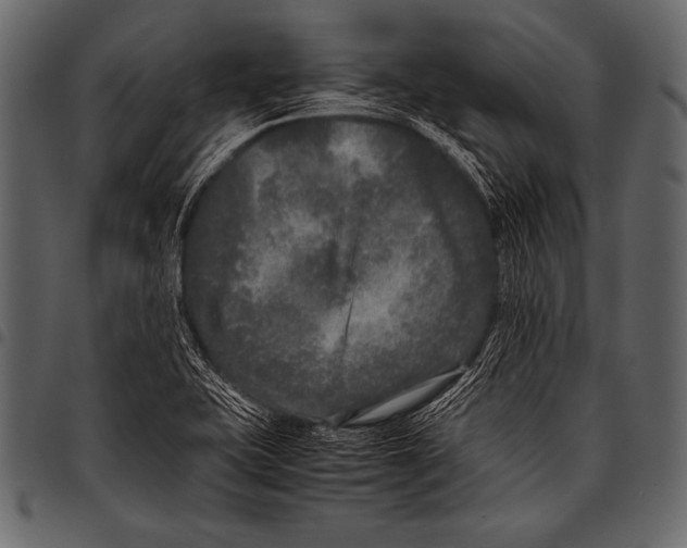 X0000097461415200803201416