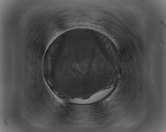 X0000097461533200803201415