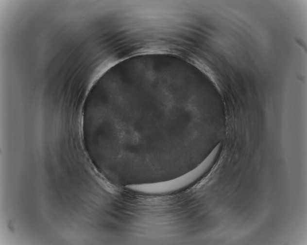 X0000097471179200803141907