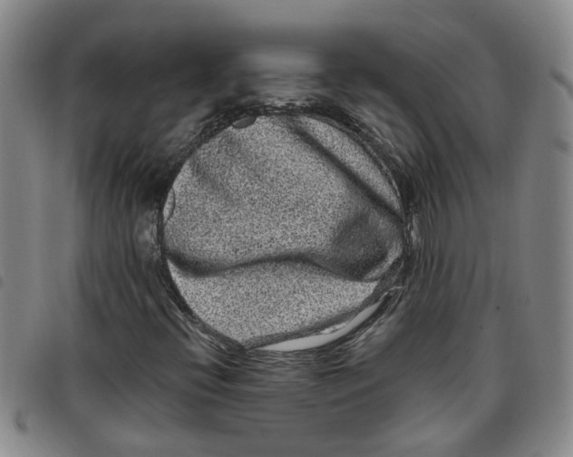 X0000097471396200803141903