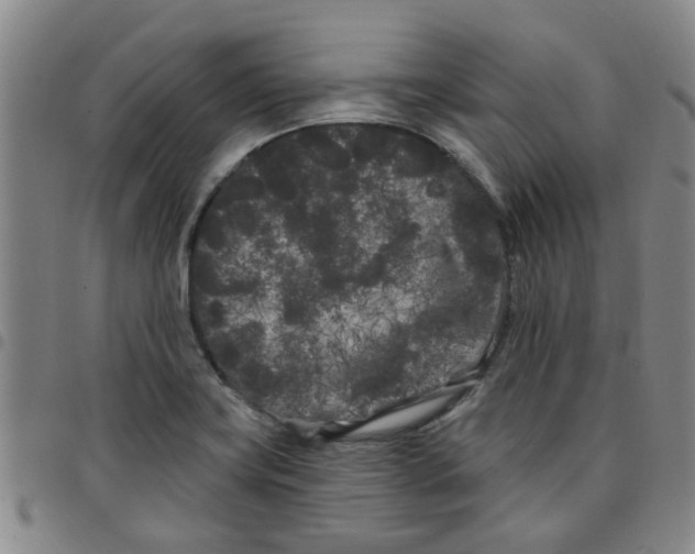 X0000097471419200803141903