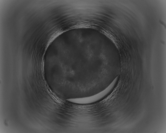 X0000097471179200803201441