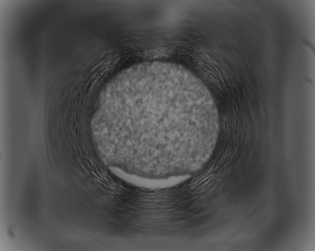 X0000097471393200803201438