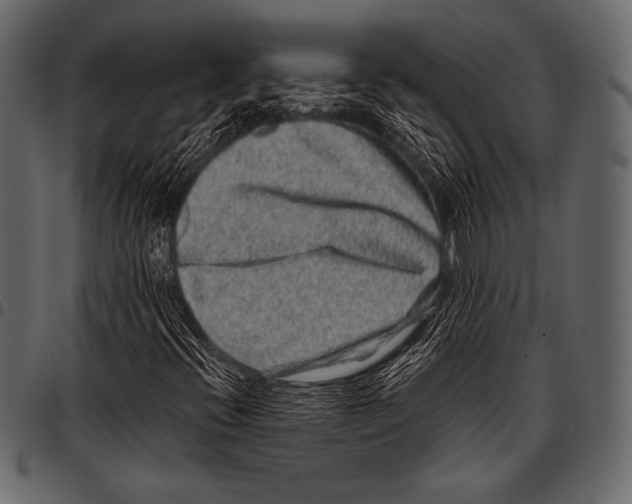 X0000097471396200803201438